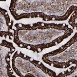 Monoamine Oxidase B Antibody in Immunohistochemistry (Paraffin) (IHC (P))