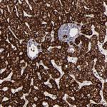 Monoamine Oxidase B Antibody in Immunohistochemistry (Paraffin) (IHC (P))