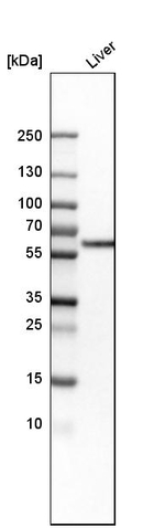 Monoamine Oxidase B Antibody in Western Blot (WB)