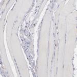 C1QA Polyclonal Antibody