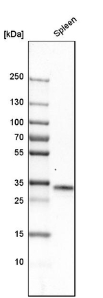 C1QA Antibody in Western Blot (WB)