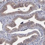 STAP2 Antibody in Immunohistochemistry (Paraffin) (IHC (P))