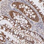STAP2 Antibody in Immunohistochemistry (Paraffin) (IHC (P))