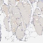 STAP2 Antibody in Immunohistochemistry (Paraffin) (IHC (P))