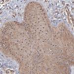 STAP2 Polyclonal Antibody