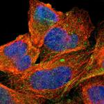 MRP1 Polyclonal Antibody