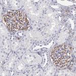 MRP1 Antibody in Immunohistochemistry (Paraffin) (IHC (P))