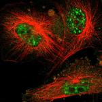 Cdc34 Polyclonal Antibody