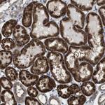 Cdc34 Antibody in Immunohistochemistry (Paraffin) (IHC (P))