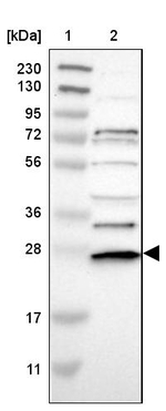 Cdc34 Antibody in Western Blot (WB)