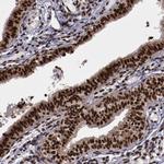 SNW1 Antibody in Immunohistochemistry (Paraffin) (IHC (P))