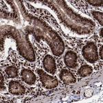 SNW1 Antibody in Immunohistochemistry (Paraffin) (IHC (P))