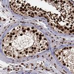 SNW1 Antibody in Immunohistochemistry (Paraffin) (IHC (P))
