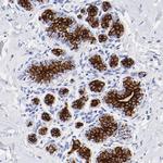 Cytokeratin 19 Antibody in Immunohistochemistry (Paraffin) (IHC (P))