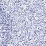 Cytokeratin 19 Antibody in Immunohistochemistry (Paraffin) (IHC (P))