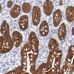 Cytokeratin 19 Antibody in Immunohistochemistry (Paraffin) (IHC (P))