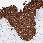 Cytokeratin 19 Antibody in Immunohistochemistry (Paraffin) (IHC (P))