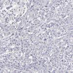 MRP4 Polyclonal Antibody