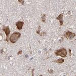 SND1 Antibody in Immunohistochemistry (Paraffin) (IHC (P))