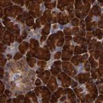 SND1 Antibody in Immunohistochemistry (Paraffin) (IHC (P))