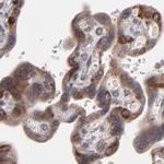 SND1 Antibody in Immunohistochemistry (Paraffin) (IHC (P))