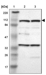 SND1 Antibody in Western Blot (WB)