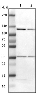 SND1 Antibody in Western Blot (WB)