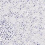 IRF8 Antibody in Immunohistochemistry (Paraffin) (IHC (P))