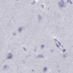 SERPINA3 Antibody in Immunohistochemistry (Paraffin) (IHC (P))