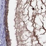 SERPINA3 Antibody in Immunohistochemistry (Paraffin) (IHC (P))