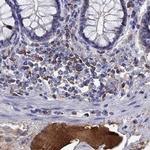 SERPINA3 Antibody in Immunohistochemistry (Paraffin) (IHC (P))