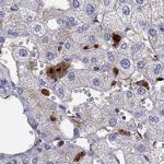 SERPINA3 Antibody in Immunohistochemistry (Paraffin) (IHC (P))