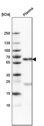 SERPINA3 Antibody in Western Blot (WB)