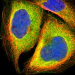 SND1 Polyclonal Antibody