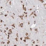 SND1 Antibody in Immunohistochemistry (Paraffin) (IHC (P))