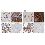 SND1 Antibody in Immunohistochemistry (Paraffin) (IHC (P))