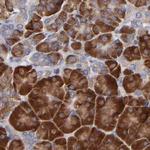 SND1 Antibody in Immunohistochemistry (Paraffin) (IHC (P))