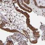 SND1 Antibody in Immunohistochemistry (Paraffin) (IHC (P))