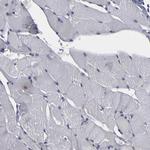 SND1 Antibody in Immunohistochemistry (Paraffin) (IHC (P))