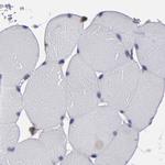 SND1 Antibody in Immunohistochemistry (Paraffin) (IHC (P))
