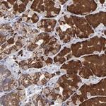 SND1 Antibody in Immunohistochemistry (Paraffin) (IHC (P))