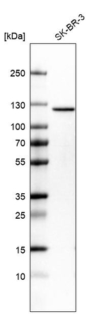 SND1 Antibody in Western Blot (WB)