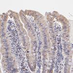 RNaseL Antibody in Immunohistochemistry (Paraffin) (IHC (P))