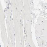CDK6 Antibody in Immunohistochemistry (Paraffin) (IHC (P))