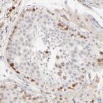 CDK6 Antibody in Immunohistochemistry (Paraffin) (IHC (P))