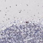 c-Raf Antibody in Immunohistochemistry (Paraffin) (IHC (P))