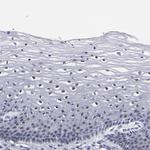 c-Raf Antibody in Immunohistochemistry (Paraffin) (IHC (P))