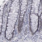 c-Raf Antibody in Immunohistochemistry (Paraffin) (IHC (P))