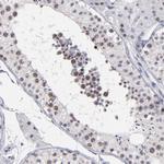 c-Raf Antibody in Immunohistochemistry (Paraffin) (IHC (P))