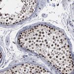 SSRP1 Polyclonal Antibody